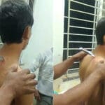 गर्दन में चाकू फंसा, 46 किमी दूर अस्पताल तक पहुंचा नाबालिग; महिदपुर में विवाद मे