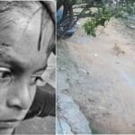 बिलासपुर में PM श्री स्कूल के अंदर कुत्ते ने छात्र-टीचर को नोचा