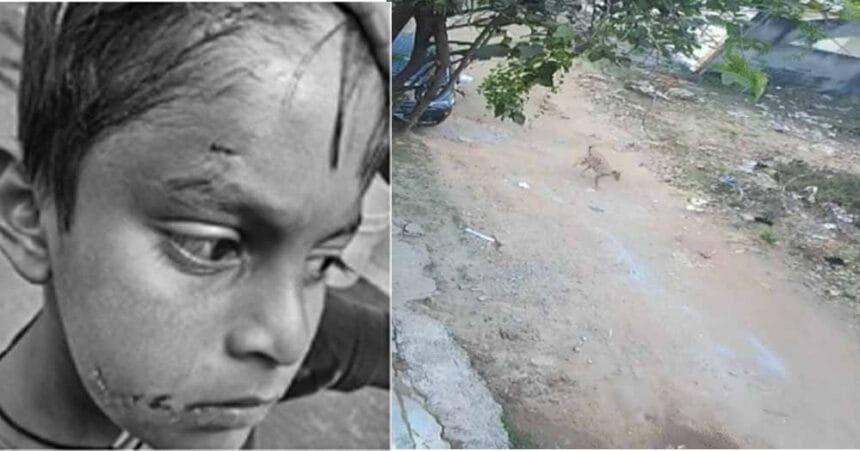 बिलासपुर में PM श्री स्कूल के अंदर कुत्ते ने छात्र-टीचर को नोचा