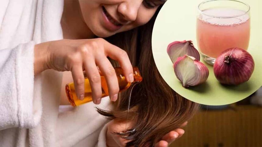 बालों के झड़ने से राहत, घर पर बनाएं प्याज का तेल