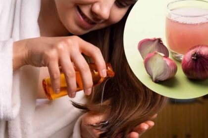 बालों के झड़ने से राहत, घर पर बनाएं प्याज का तेल