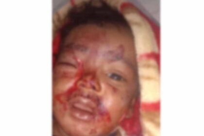 आंगन में खेल रहे 6 माह के मासूम को आवारा कुत्ते ने काटा, जिला अस्पताल में भर्ती