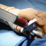 थैलीसीमिया पीड़ितों के लिए बड़ा ऐलान, मुफ्त ट्रांसप्लांट और पेंशन योजना जारी