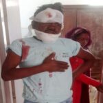 ब्रेकर में बाइक जैंपिंग होने से हादसा: चालक को आया गंभीर रूप से जख्म