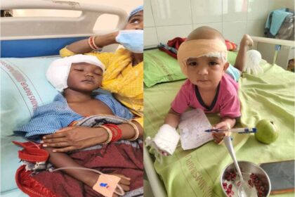 चिरायु योजना से बदली जिंदगी, एम्स रायपुर में तीन बच्चों का सफल कॉक्लियर इंप्लांट