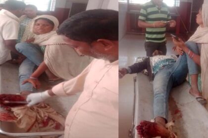 ऑटो और बाइक की टक्कर में बाइक चालक को गंभीर चोटें, पैर की दो उंगलियां टूटने की आ