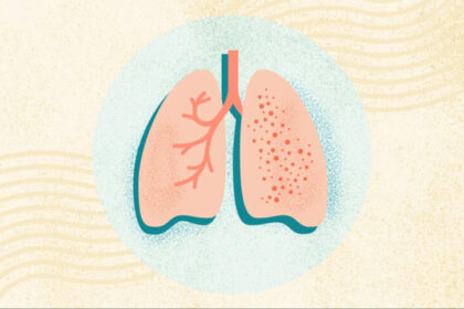 टीबी को न्योता दे रही कमजोर रोग-प्रतिरोधक क्षमता, पहचानें शुरुआती लक्षण और करें