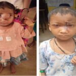 पिता के संघर्ष को मिला साथ – चिरायु योजना ने बचाई अंजलि की जिंदगी